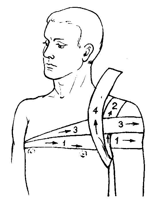 Повязка при ранении плеча